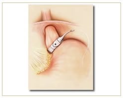 Slider image (2) Panama Gastric Surgery Center